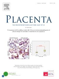 Placenta