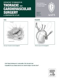 Operative Techniques in Thoracic and Cardiovascular Surgery