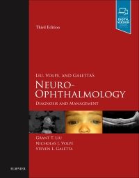 Liu, Volpe, and Galetta’s Neuro-Ophthalmology