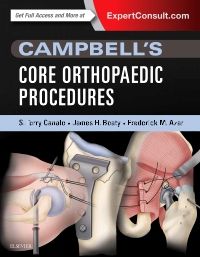 Campbell's Core Orthopaedic Procedures