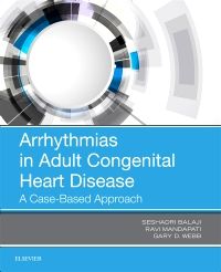 Arrhythmias in Adult Congenital Heart Disease