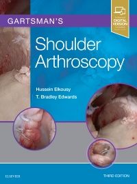 Gartsman's Shoulder Arthroscopy