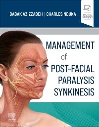 Management of Post-Facial Paralysis Synkinesis