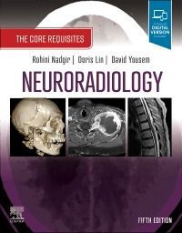 Neuroradiology