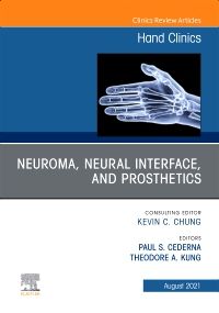 Neuroma, Neural interface, and Prosthetics, An Issue of Hand Clinics