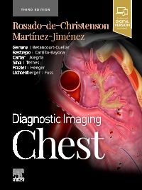 Diagnostic Imaging: Chest