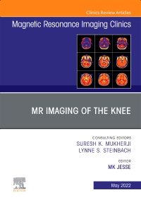 MR Imaging of The Knee, An Issue of Magnetic Resonance Imaging Clinics of North America