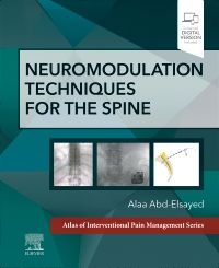 Spinal Cord Stimulator - Atlas Pain Management Clinic