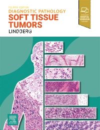 Diagnostic Pathology: Soft Tissue Tumors