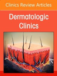 Psoriasis: Contemporary and Future Therapies, An Issue of Dermatologic Clinics