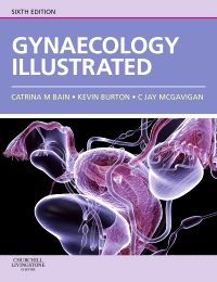 Gynaecology Illustrated