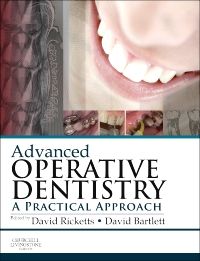 Advanced Operative Dentistry