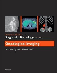 Grainger & Allison’s Diagnostic Radiology: Oncological Imaging