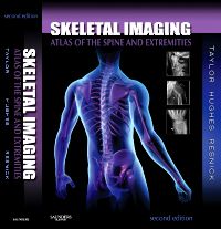 Skeletal Imaging