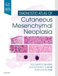 Diagnostic Atlas of Cutaneous Mesenchymal Neoplasia