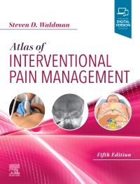 Spinal Cord Stimulator - Atlas Pain Management Clinic