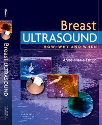 Boobie Bikkies - Big Boobs,Small Boobs and Breast Milk Supply - Does Size  Matter? Ultrasound studies by Dr Peter Hartmann and team at the University  of Western Australia have shown that although