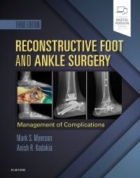 Reconstructive Foot and Ankle Surgery: Managemen - 9780323496933