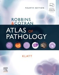 Robbins and Cotran Atlas of Pathology - 9780323640183