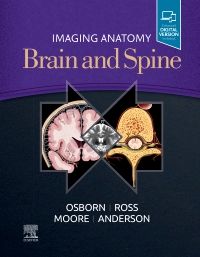 洋書 Expert ddx brain and spine ExpertDDx: Brain and Spine: 9780443106941: Medicine & Health