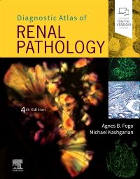 Diagnostic Atlas of Renal Pathology - 9780323721639