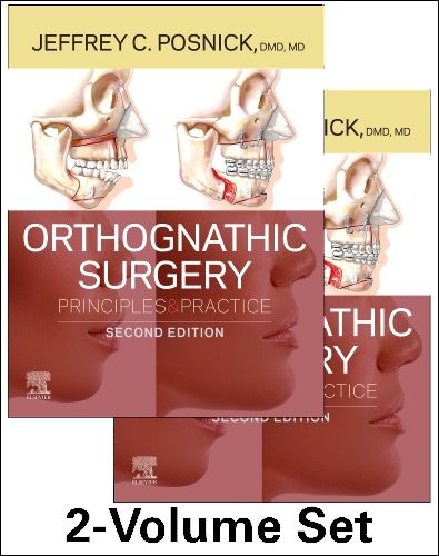 Orthognathic Surgery - 2 Volume Set - 9780323791823