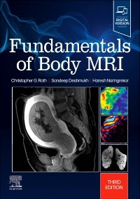 Fundamentals of Body MRI - 9780323833813