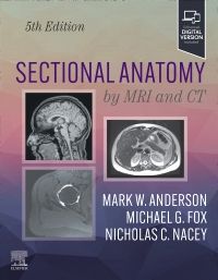 健康・医学 MRI ARTHROSCOPY and SURGICAL ANATOMY MRI-Arthroscopy Correlations: A Case-Based Atlas of the Knee
