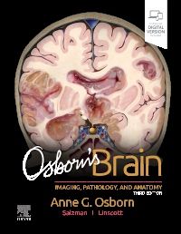 Osborn's Brain:他合わせて5冊 Osborn's Brain - 9780443109379