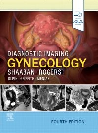 Diagnostic Imaging Obstetrics 第三版 Diagnostic Imaging: Obstetrics: 9780323793964: Medicine