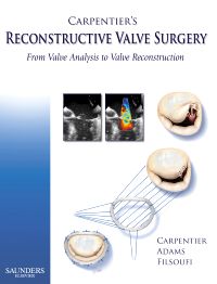 カーペンティアReconstructive valve surgery Carpentier's Reconstructive Valve Surgery - 9780721691688