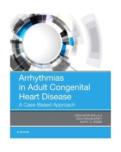 Arrhythmias in Adult Congenital Heart Disease