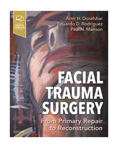 Facial Trauma Surgery