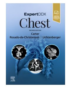 ExpertDDx: Chest