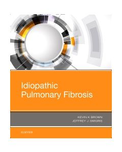 Idiopathic Pulmonary Fibrosis