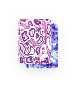 ImmunoQuery