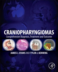 Craniopharyngiomas: Comprehensive Diagnosis, Treatment and Outcome, 1st Edition